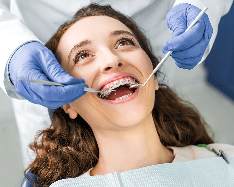 How to Choose Braces